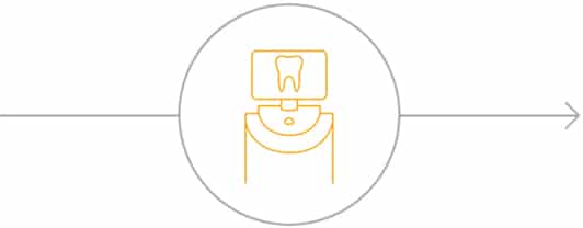 @ET-DC@eyJkeW5hbWljIjp0cnVlLCJjb250ZW50IjoicG9zdF90aXRsZSIsInNldHRpbmdzIjp7ImJlZm9yZSI6IiIsImFmdGVyIjoiIn19@ Cerec Smile In A Day