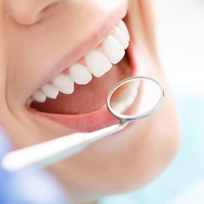 teeth-bonding-leicester-dentist Cosmetic Treatments