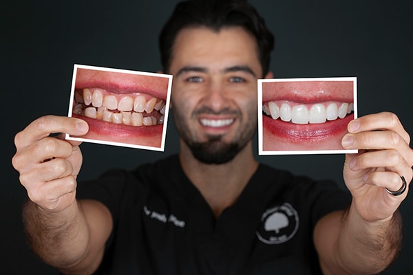 smile-makeover-600x400px home