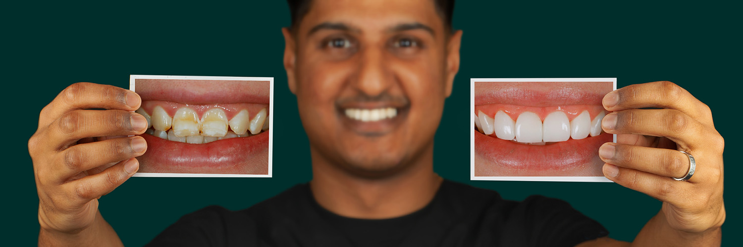 bonding-leicester-mobile Before & After
