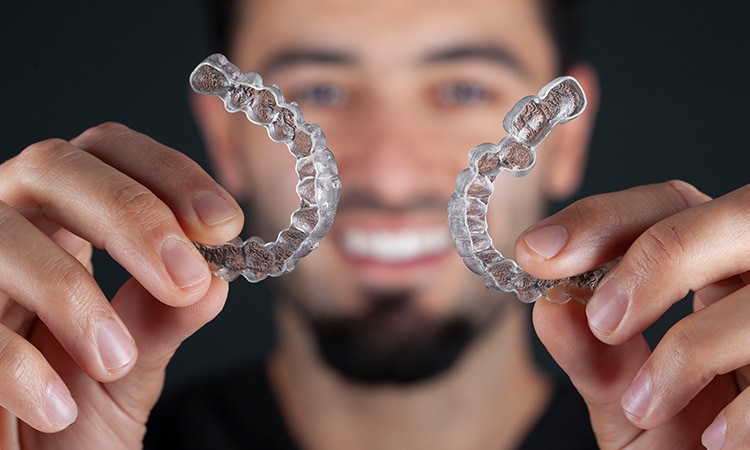 braces-m Before & After