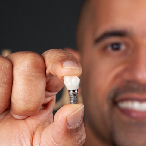 Missing Teeth Dental Implants