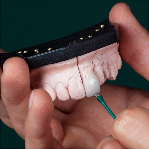Missing Teeth Dental Implants