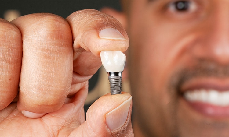 implant-d Before & After
