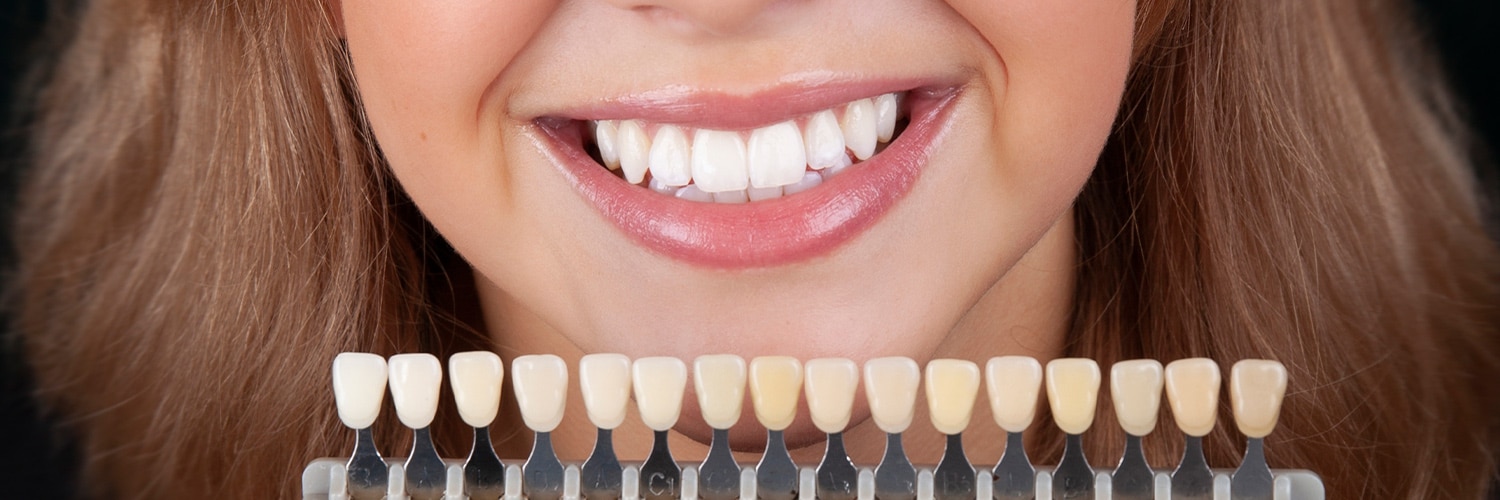 teeth-whitening-leciester-m Teeth Whitening