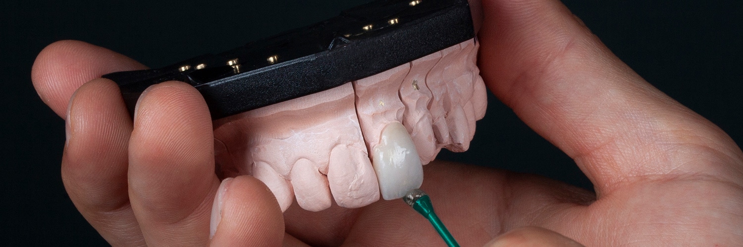 teeth-whitening-leciester-m Dental Veneers