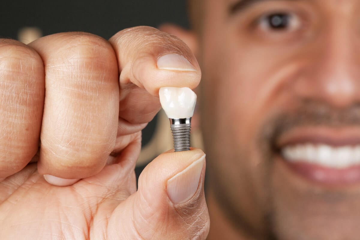 Dental Implants