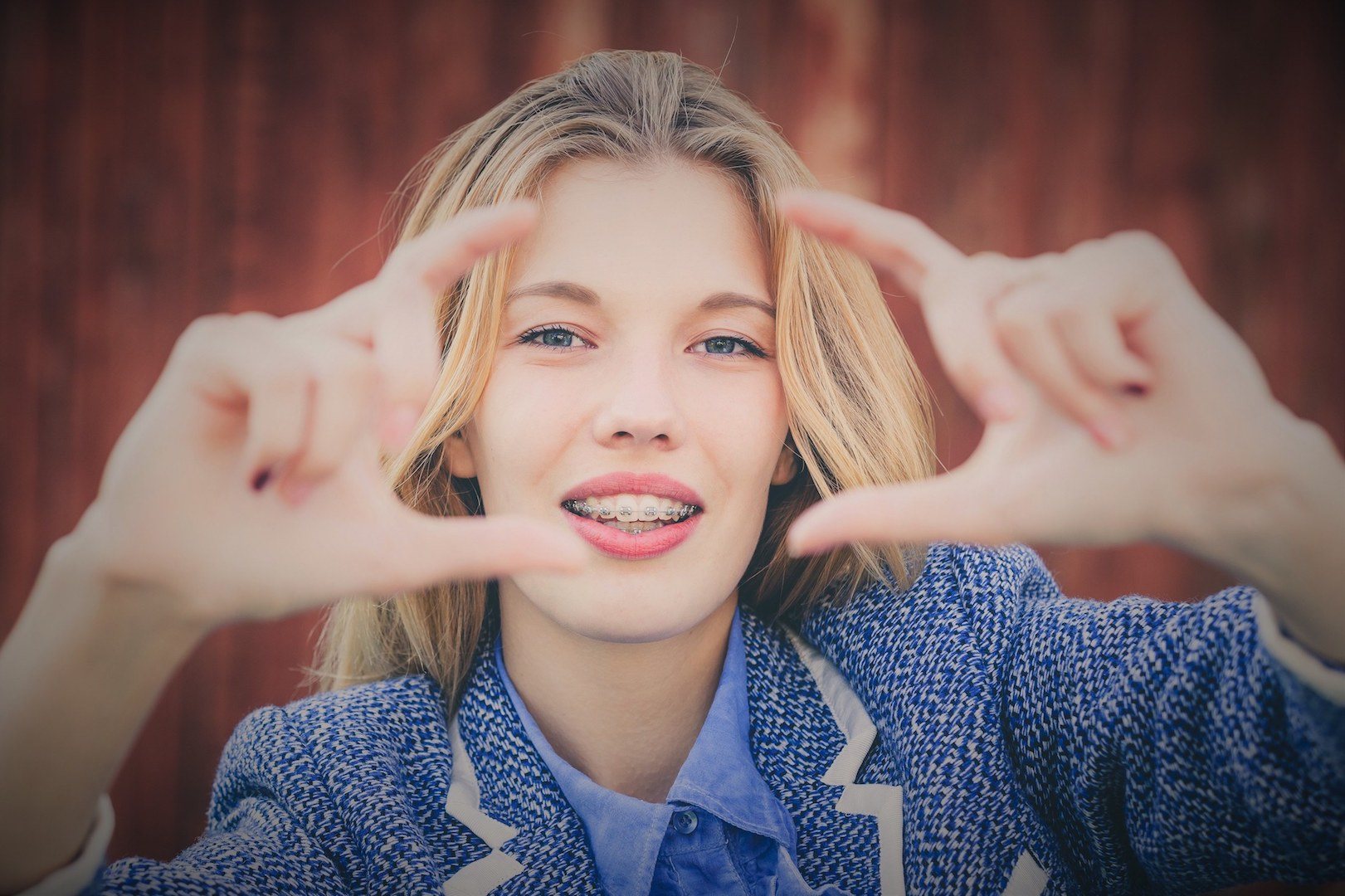 Teeth straightening Teeth straightening